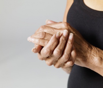 Invecchiamento cutaneo del dorso delle mani