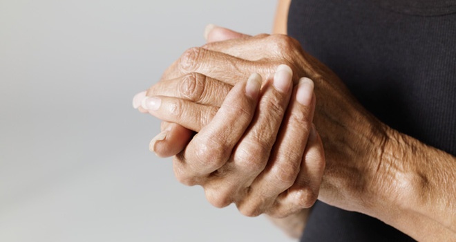 Invecchiamento cutaneo del dorso delle mani